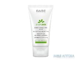 Babe Laboratorios (Бабе Лабораторіос) Stop AKN Маска для обличчя себорегулююча з білою глиною 50 мл