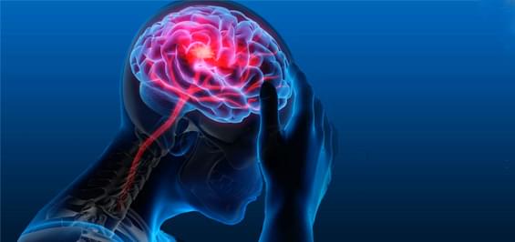 Инсульт головного мозга: как он выглядит и почему действовать нужно быстро