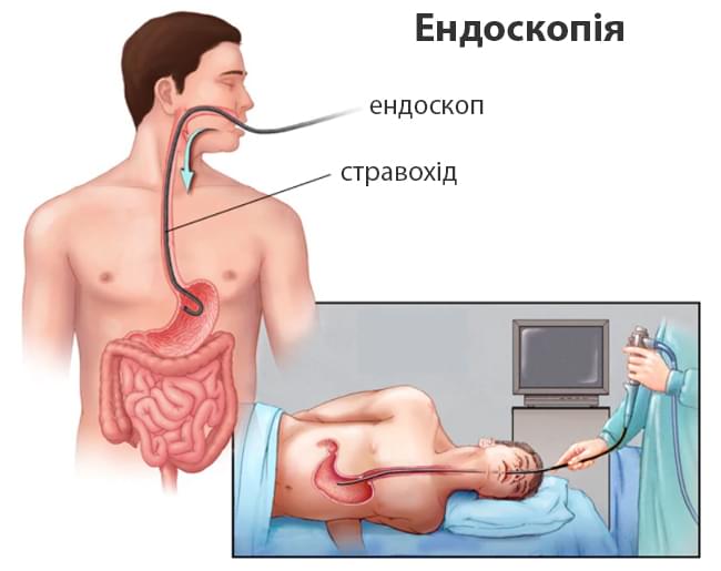 ендоскопія