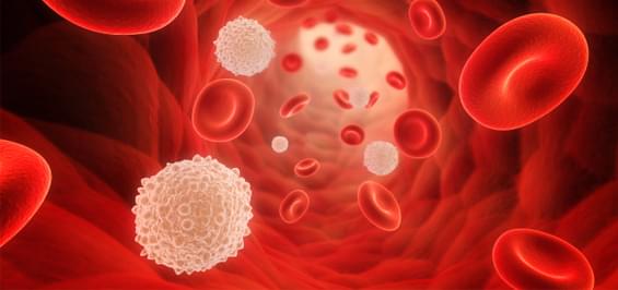 Лейкемія: рак крові, званий білокрів'ям