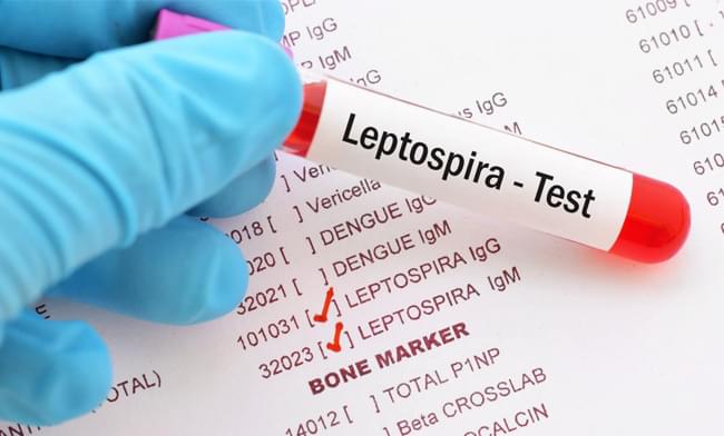 диагностика лептоспироза