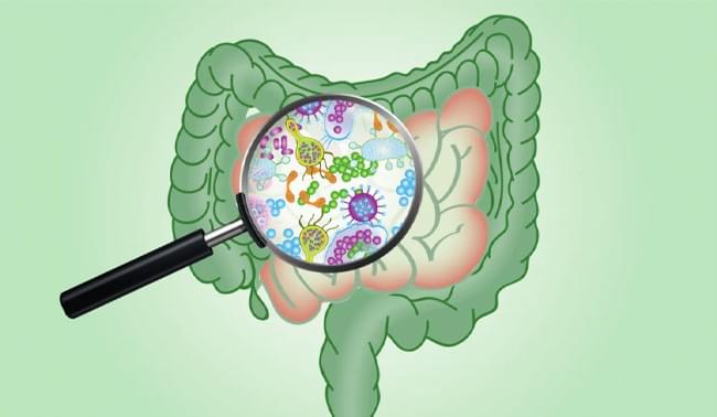 синдром избыточного бактериального роста в кишечнике