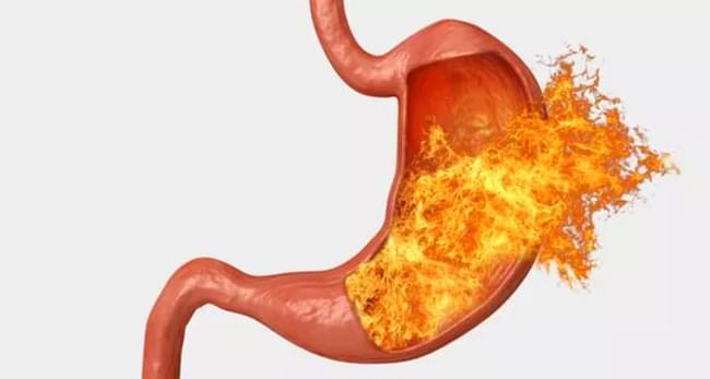 печія підвищена кислотність шлунку