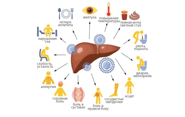 Se puede curar la hepatitis c