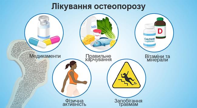 профілактика остеопорозу
