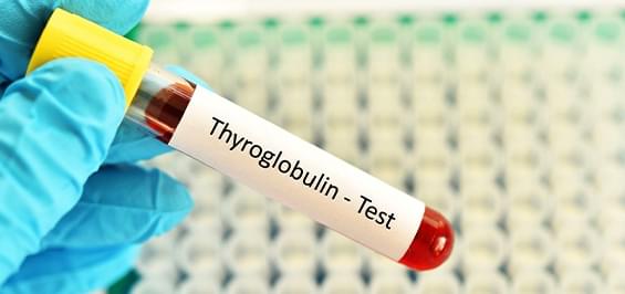 Що показує аналіз на тиреоглобулін (ТГ) та навіщо його здавати?