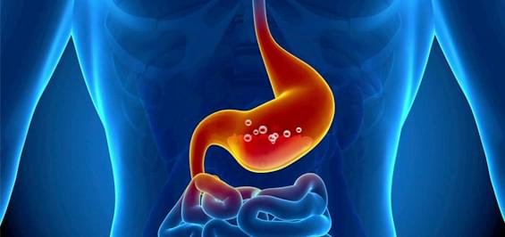 Підвищена кислотність шлунка: 5 головних симптомів