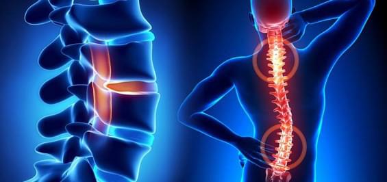 Остеохондроз, види і причини болю в спині