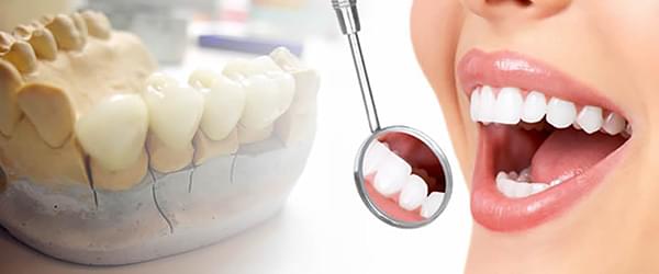 протезированние  зубов
