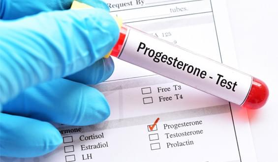 визначення прогестерону 