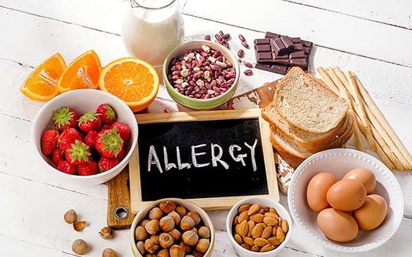 харчова алергія